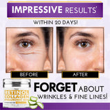 Benefits Of Anti-Wrinkle Cream - Dimdaa